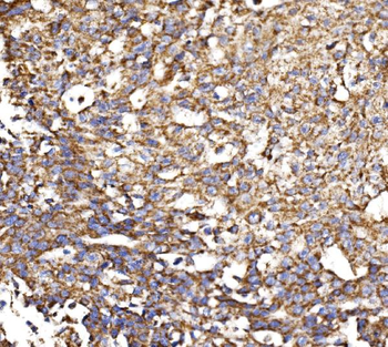 MDH2 Rabbit Polyclonal Antibody