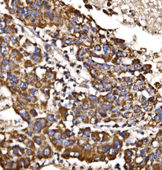 MDH2 Rabbit Polyclonal Antibody