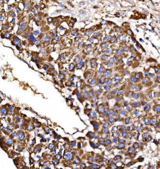 MDH2 Rabbit Polyclonal Antibody
