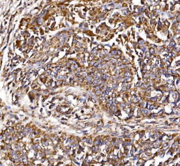 MDH2 Rabbit Polyclonal Antibody