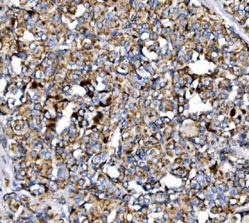 MDH2 Rabbit Polyclonal Antibody