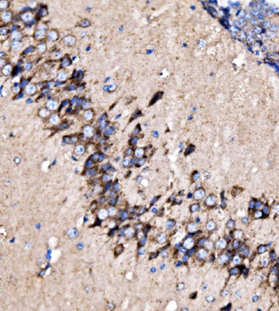 MDH2 Rabbit Polyclonal Antibody