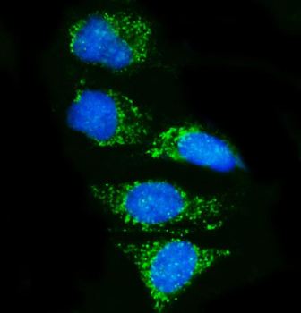 Pyrin/MEFV Rabbit Polyclonal Antibody