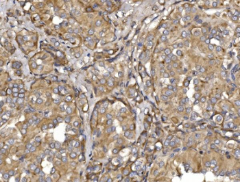 Pyrin/MEFV Rabbit Polyclonal Antibody