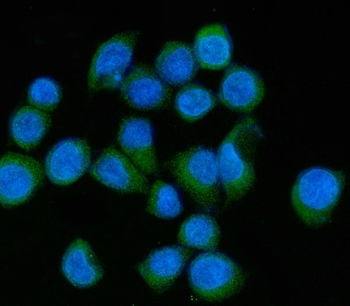 MLX-interacting protein/MLXIP/MLX Rabbit Polyclonal Antibody
