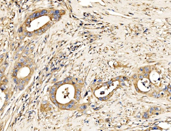 MLX-interacting protein/MLXIP/MLX Rabbit Polyclonal Antibody