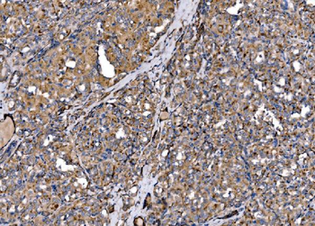 MLX-interacting protein/MLXIP/MLX Rabbit Polyclonal Antibody