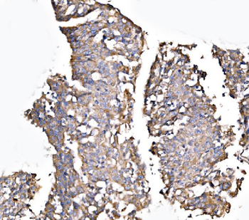 MLX-interacting protein/MLXIP/MLX Rabbit Polyclonal Antibody