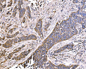 MLX-interacting protein/MLXIP/MLX Rabbit Polyclonal Antibody