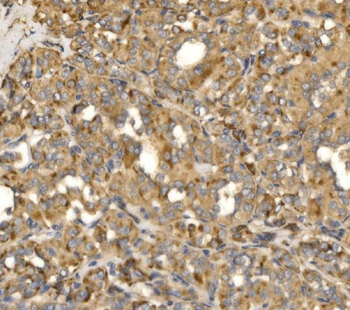 MLX-interacting protein/MLXIP/MLX Rabbit Polyclonal Antibody
