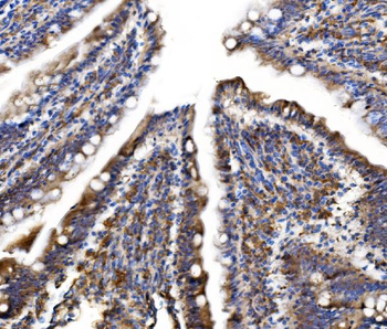 MLX-interacting protein/MLXIP/MLX Rabbit Polyclonal Antibody