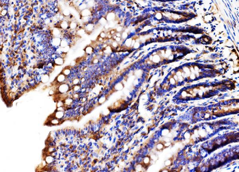 MLX-interacting protein/MLXIP/MLX Rabbit Polyclonal Antibody