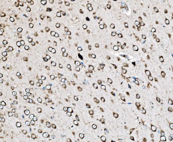 MRPS25 Rabbit Polyclonal Antibody