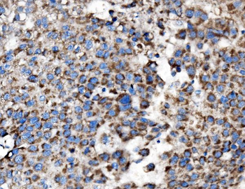 MRPS25 Rabbit Polyclonal Antibody