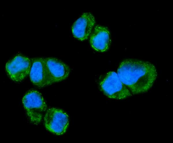 NDUFAF1 Rabbit Polyclonal Antibody