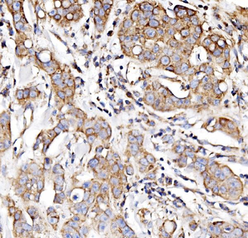 NDUFAF1 Rabbit Polyclonal Antibody