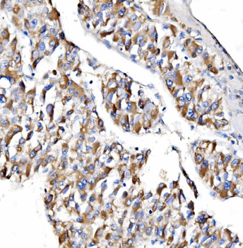 NDUFAF1 Rabbit Polyclonal Antibody