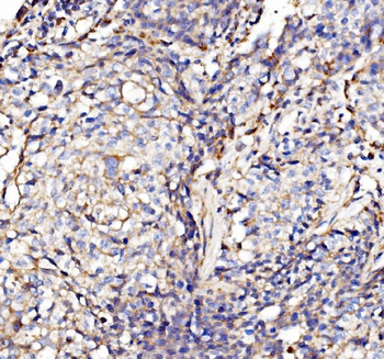 NDUFAF1 Rabbit Polyclonal Antibody