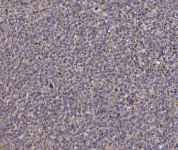 NDUFAF1 Rabbit Polyclonal Antibody