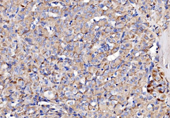 NDUFAF1 Rabbit Polyclonal Antibody