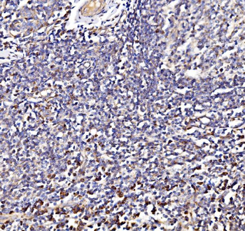 NDUFAF1 Rabbit Polyclonal Antibody