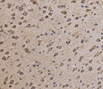 NDUFAF1 Rabbit Polyclonal Antibody