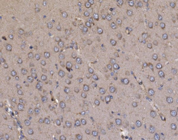 NDUFAF1 Rabbit Polyclonal Antibody