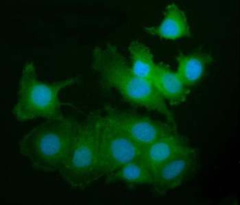 PAK2 Rabbit Polyclonal Antibody
