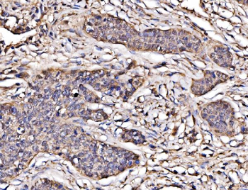 PAK2 Rabbit Polyclonal Antibody