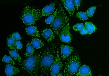 PAK3 Rabbit Polyclonal Antibody
