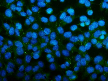 PAR-3/PARD3/PAR Rabbit Polyclonal Antibody
