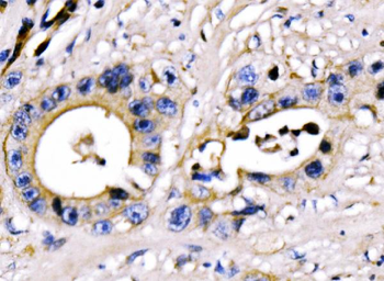 PAR-3/PARD3/PAR Rabbit Polyclonal Antibody