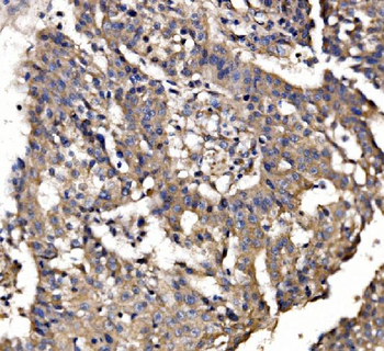 PAR-3/PARD3/PAR Rabbit Polyclonal Antibody