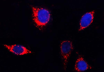 PITRM1 Rabbit Polyclonal Antibody