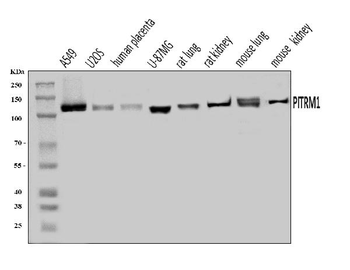 PITRM1 Rabbit Polyclonal Antibody