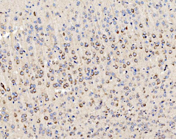 PMPCA/INPP5 Rabbit Polyclonal Antibody