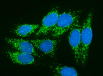 PMPCA/INPP5 Rabbit Polyclonal Antibody