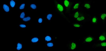 POLA1 Rabbit Polyclonal Antibody