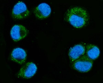 MIRO1/RHOT1 Rabbit Polyclonal Antibody