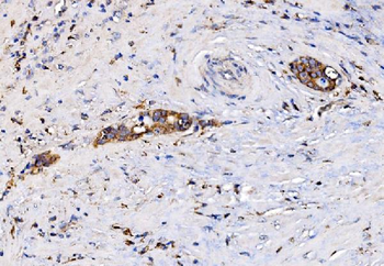 MIRO1/RHOT1 Rabbit Polyclonal Antibody