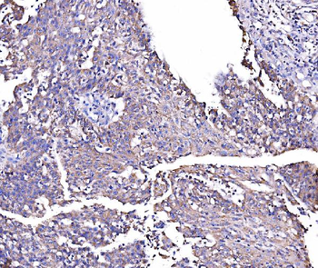 MIRO1/RHOT1 Rabbit Polyclonal Antibody