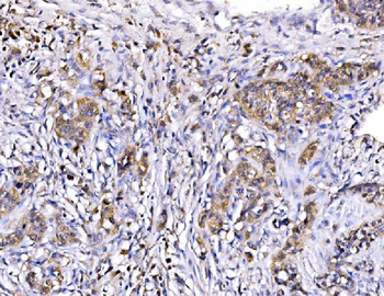 MIRO1/RHOT1 Rabbit Polyclonal Antibody