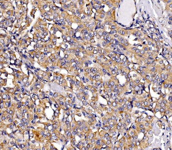 MIRO1/RHOT1 Rabbit Polyclonal Antibody