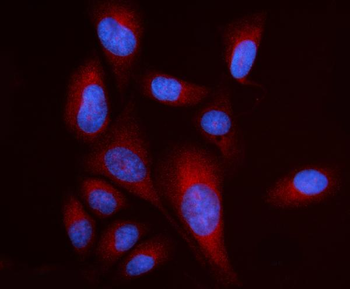 RPL17 Rabbit Polyclonal Antibody
