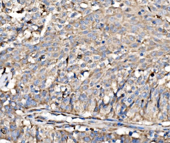 RPL17 Rabbit Polyclonal Antibody
