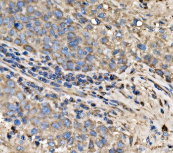 RPL17 Rabbit Polyclonal Antibody