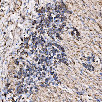 RPL17 Rabbit Polyclonal Antibody