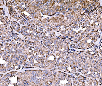 RPL17 Rabbit Polyclonal Antibody