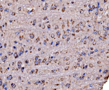 RPL17 Rabbit Polyclonal Antibody