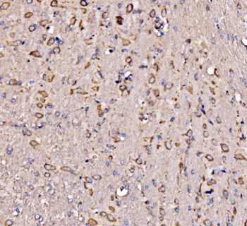 RPL17 Rabbit Polyclonal Antibody